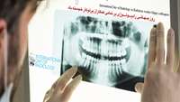 17 آبان ، روز جهانی رادیولوژی